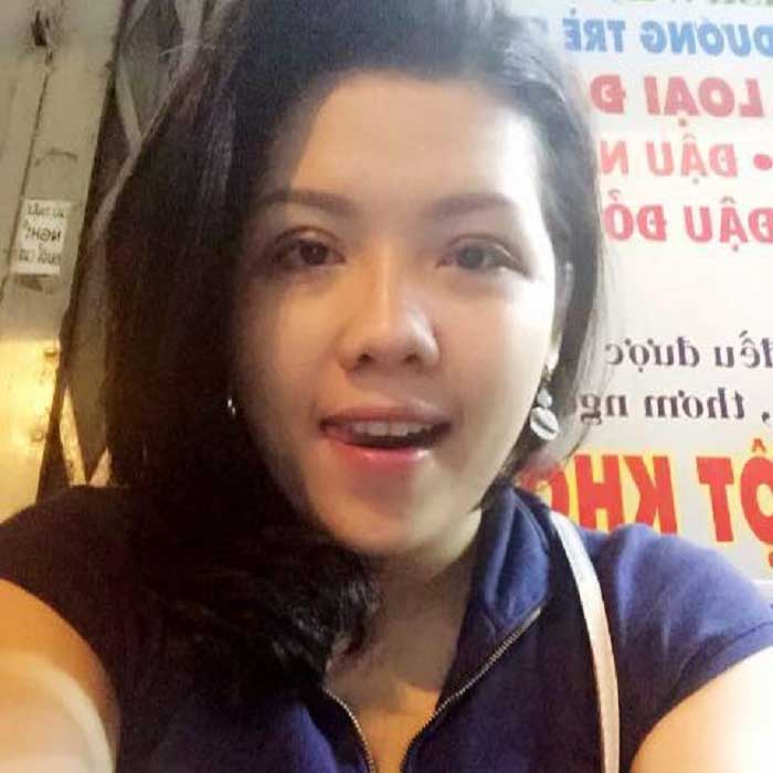 Cắt mí mắt