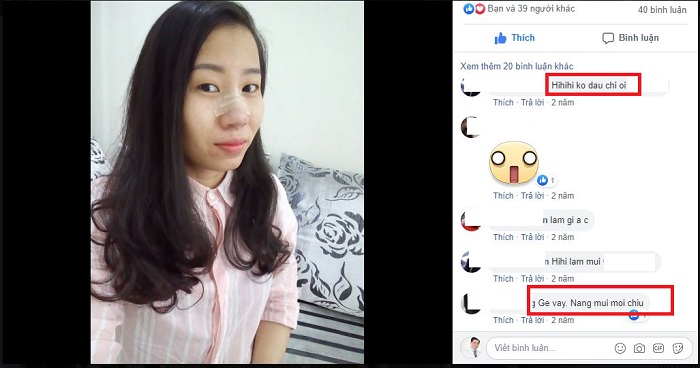 Nâng mũi Hàn Quốc