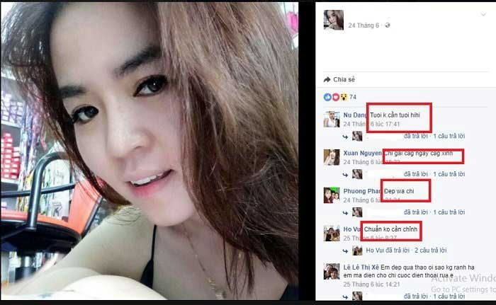 Nâng mũi Hàn Quốc