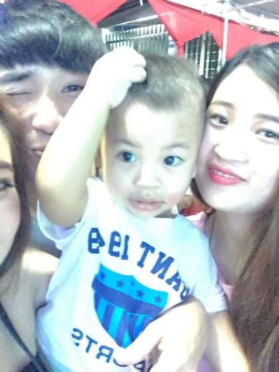 Bấm mí Hàn Quốc