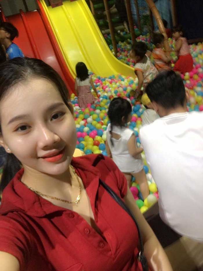 Nâng mũi bọc sụn
