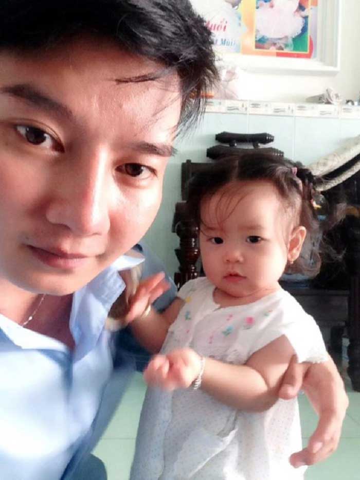 Nâng mũi bọc sụn