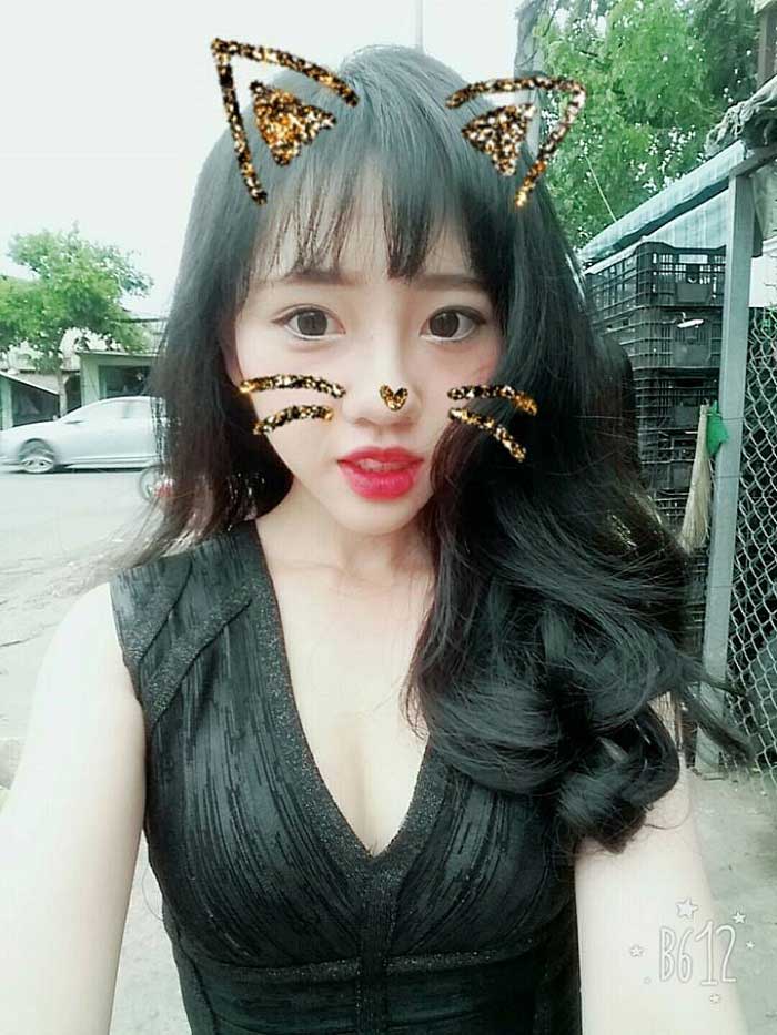 Nâng mũi bọc sụn