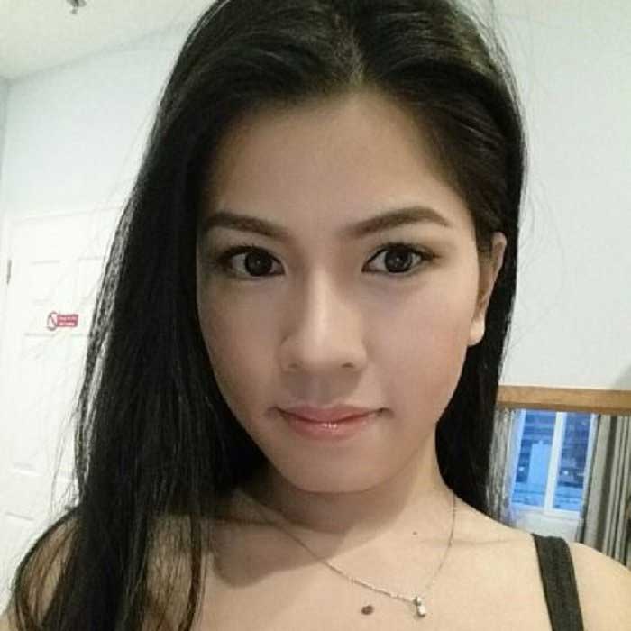Lấy mỡ má