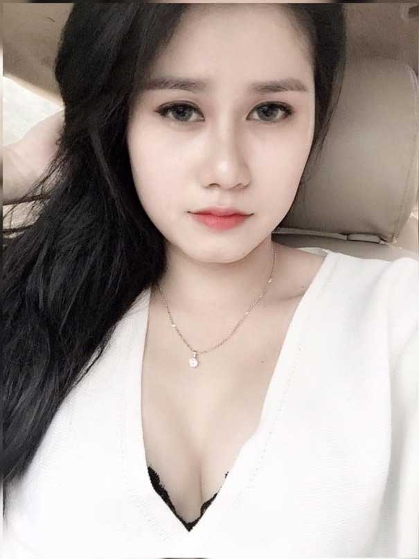 Nâng mũi S Line