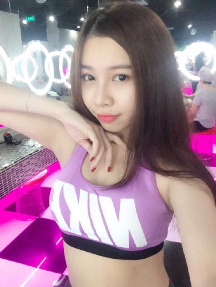 Nâng mũi bọc sụn