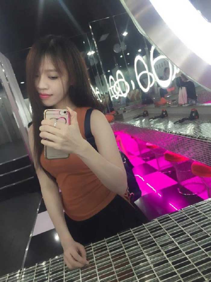 Nâng mũi bọc sụn