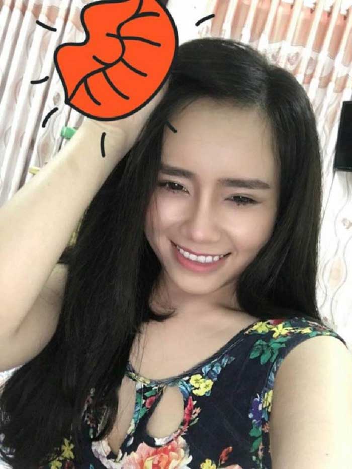 Nâng mũi bọc sụn