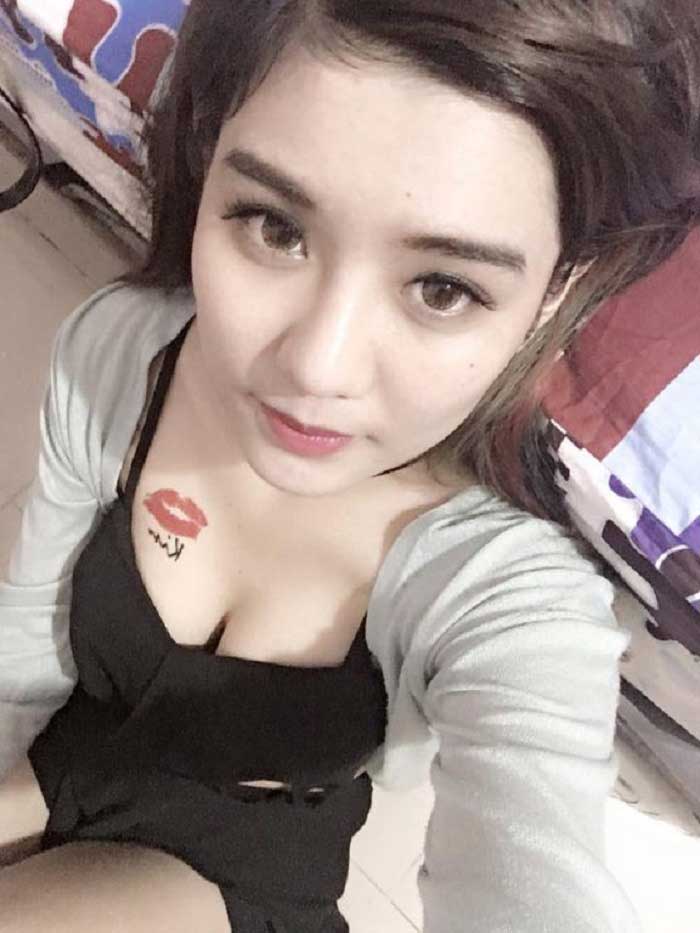 Nâng mũi bọc sụn