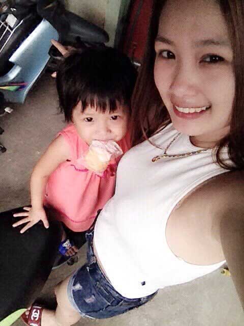 Nâng ngực nội soi