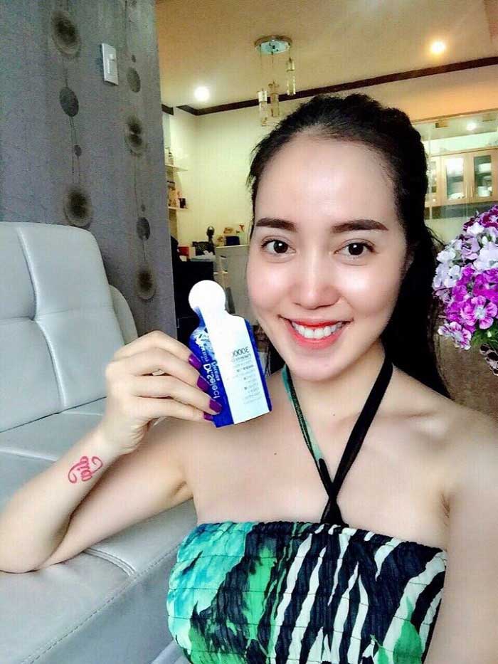 Cắt mí mắt