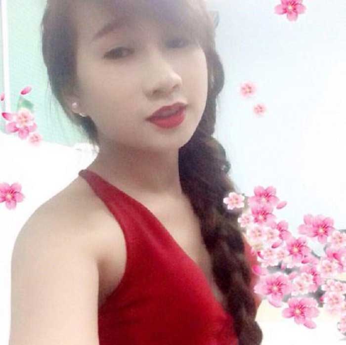 Nâng mũi bọc sụn