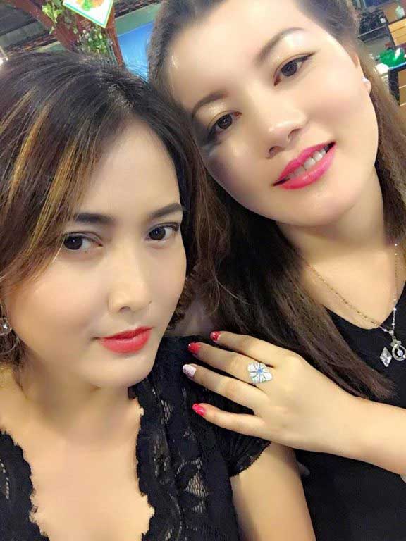 Căng da mặt Căng da mặt