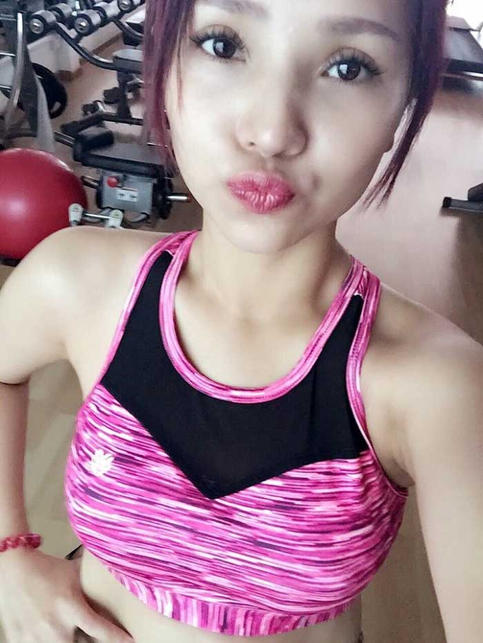 Cắt mí mắt
