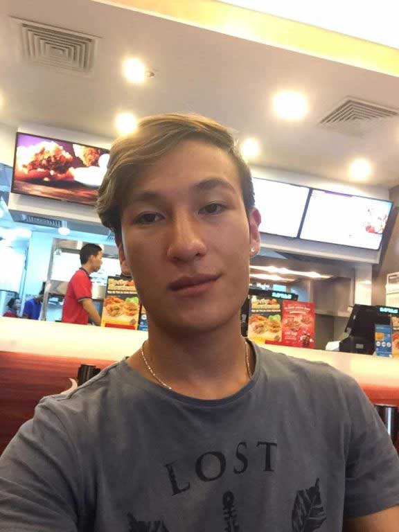 Làm đầy môi