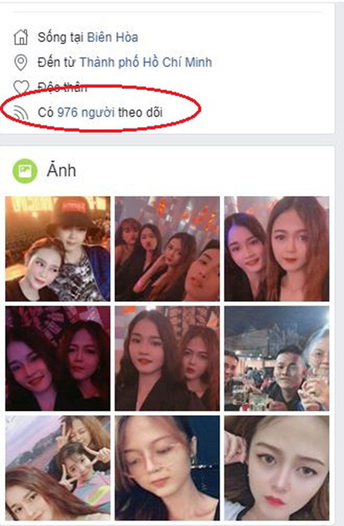 Nâng mũi bọc sụn