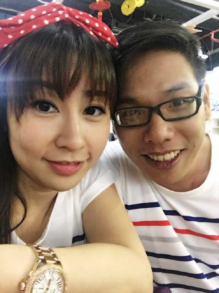 Cắt mí mắt