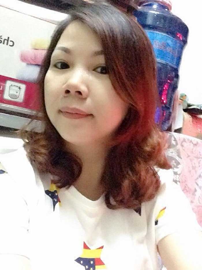 Cắt mí mắt