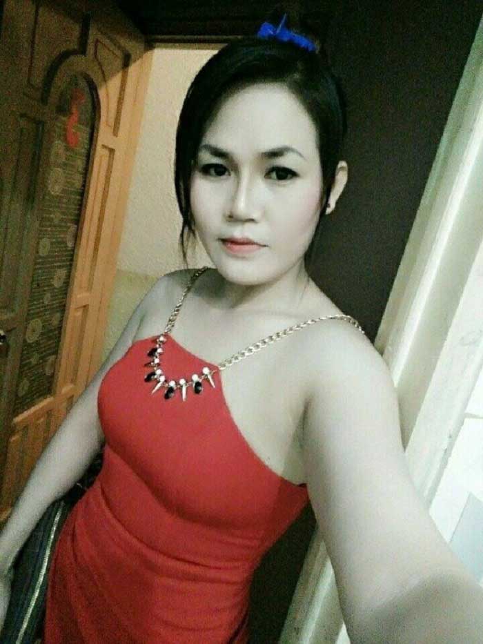 Nâng mũi bọc sụn