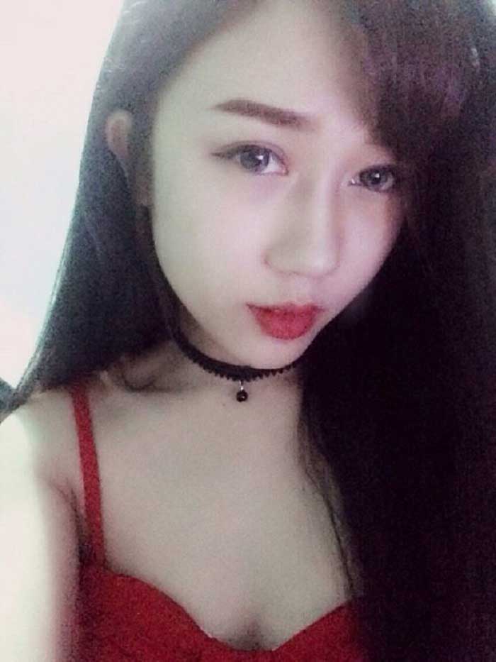 Cắt mí mắt