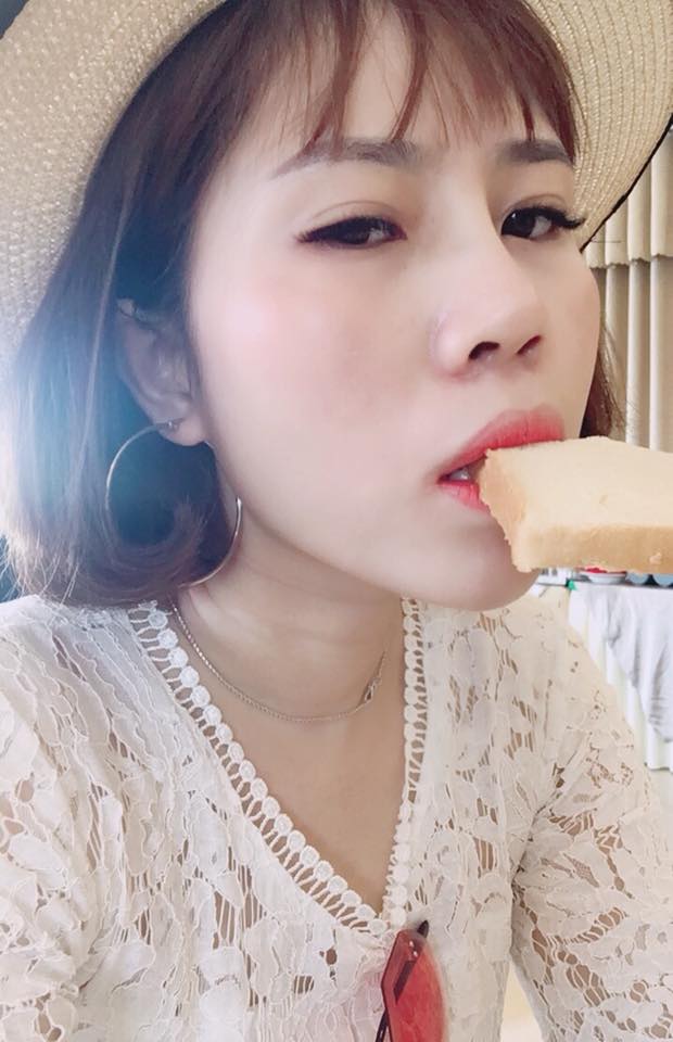 Nâng mũi bọc sụn