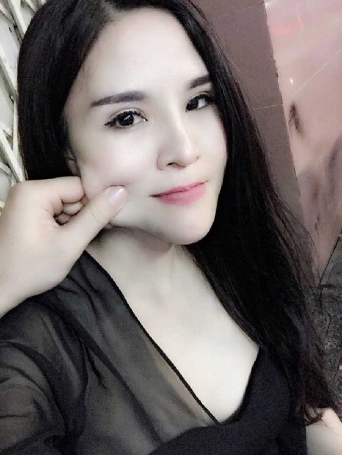 Nâng mũi Hàn Quốc