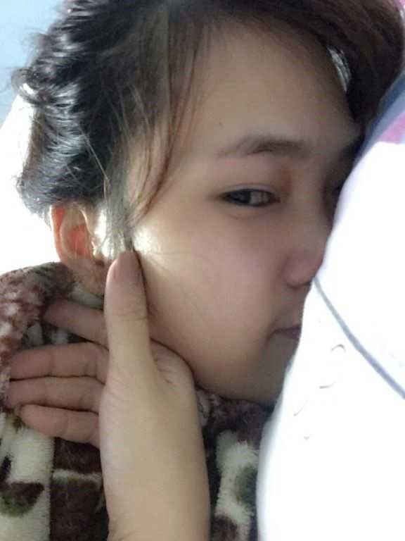 Bấm mí Hàn Quốc