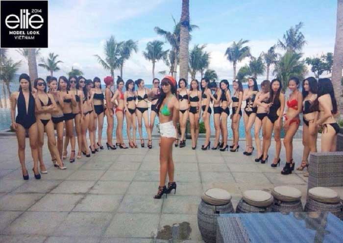 Nâng mũi bọc sụn