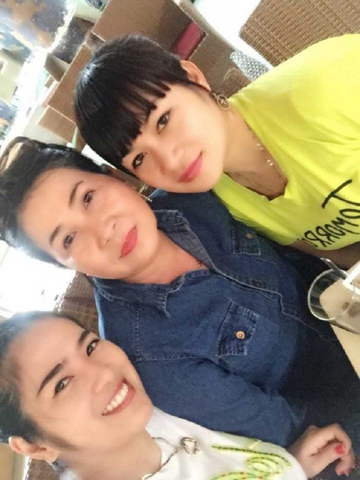 Cắt mí mắt
