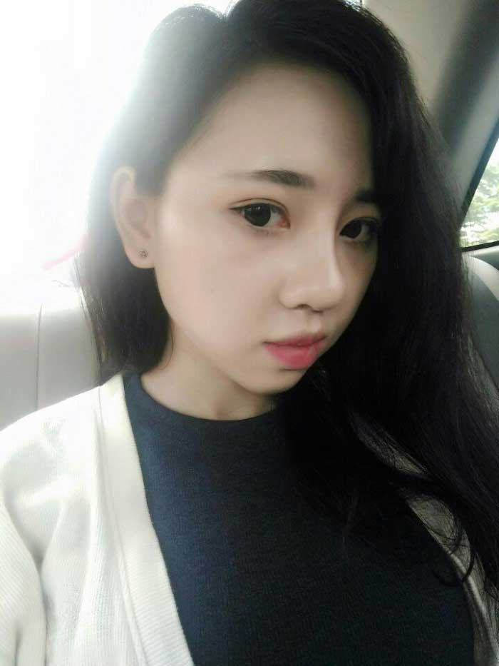 Độn cằm