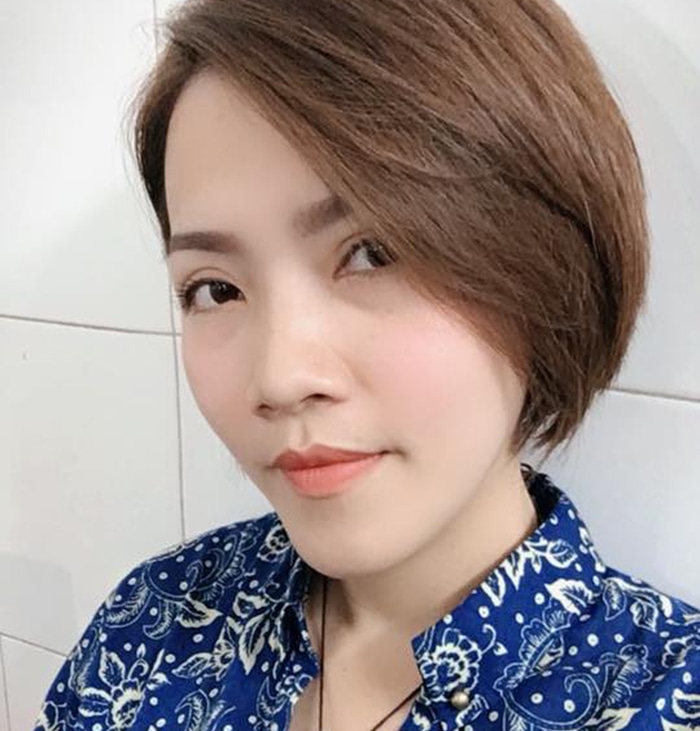 Cắt mí mắt