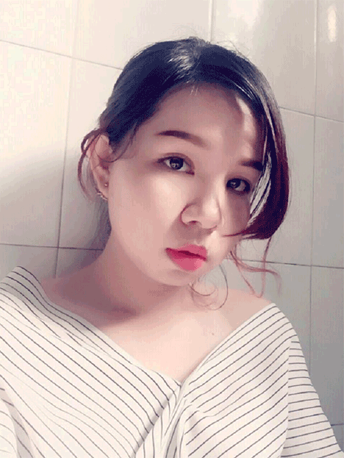 Cắt mí mắt