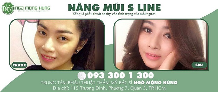Cẩm Vân đẹp kiêu kỳ sang trọng sau nâng mũi S Line