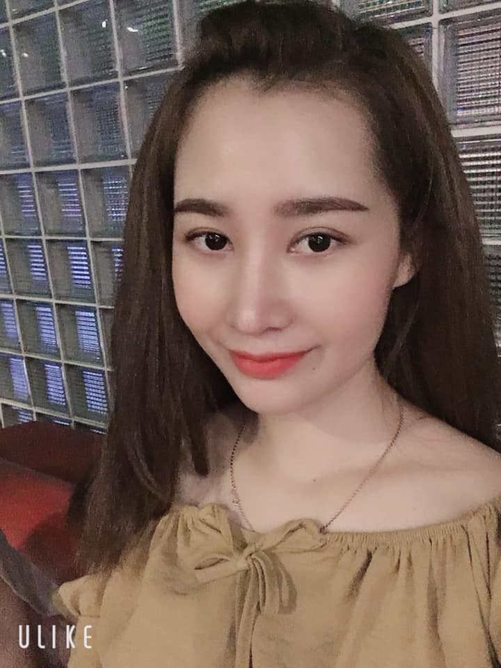 Độn cằm