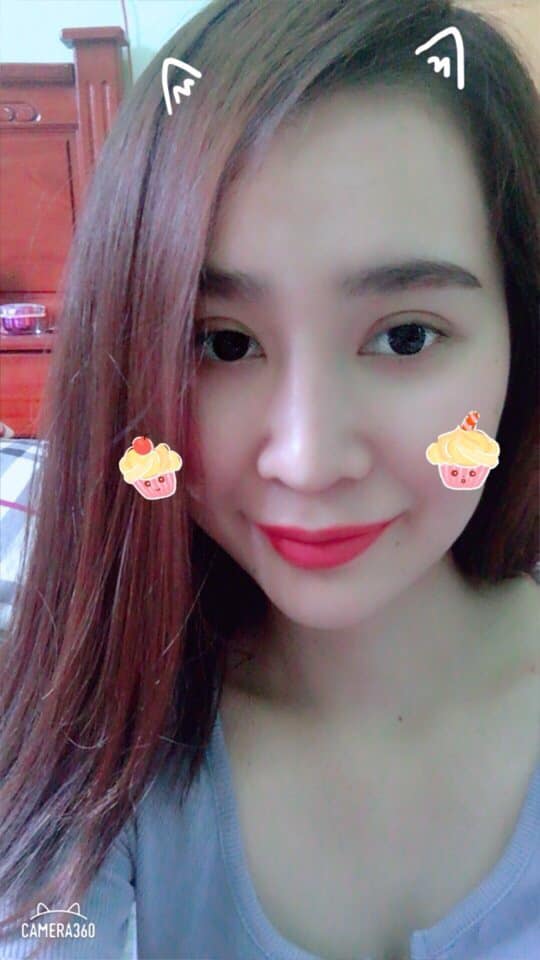 Độn cằm