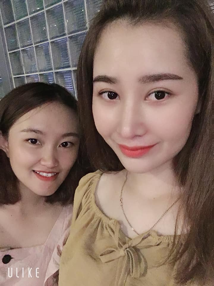 Độn cằm