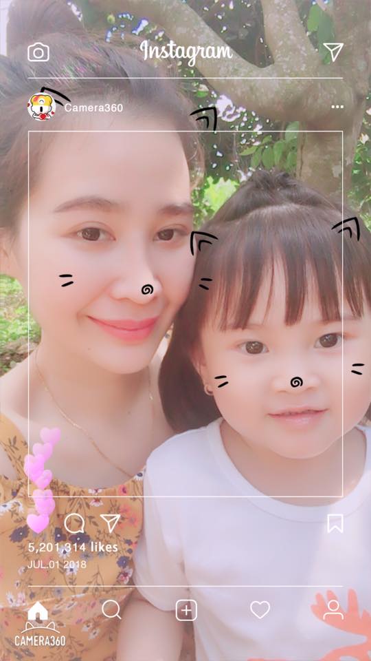 Độn cằm