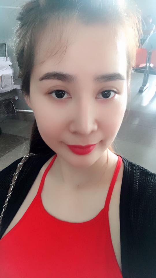 Độn cằm