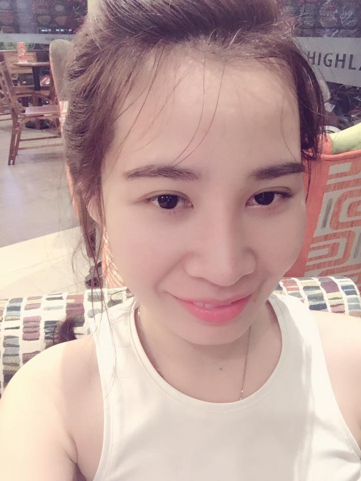 Độn cằm