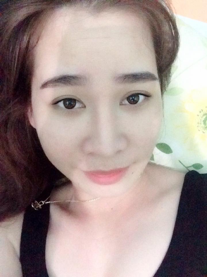 Độn cằm