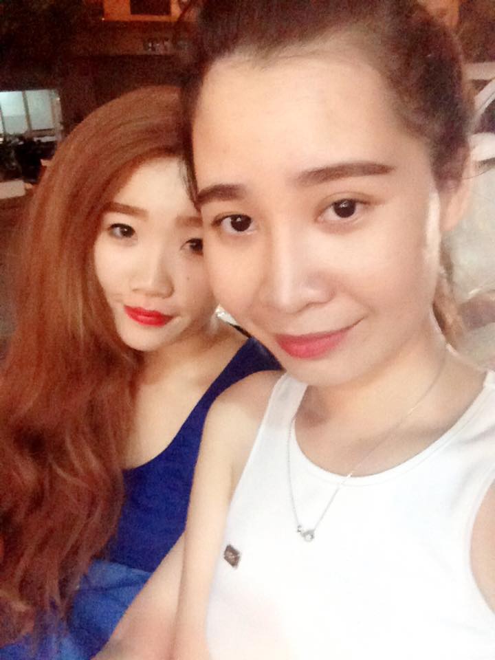 Độn cằm