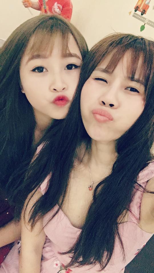 Nâng mũi bọc sụn