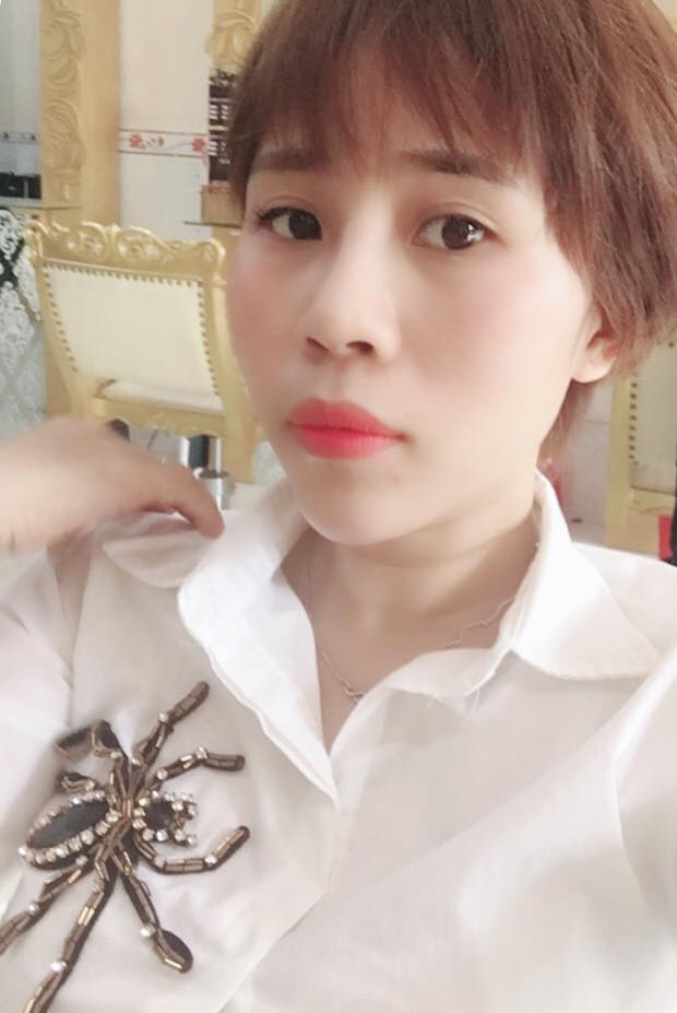 Nâng mũi bọc sụn
