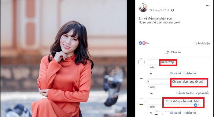 Nâng mũi bọc sụn