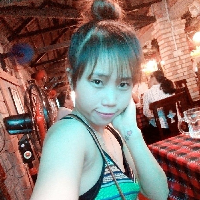 Nâng mũi bọc sụn