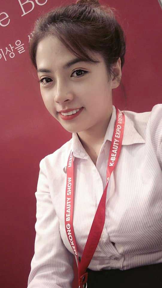 Nâng mũi bọc sụn