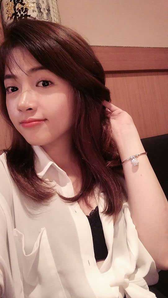 Nâng mũi bọc sụn