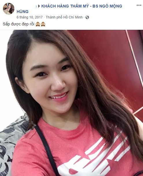 Bấm mí Hàn Quốc