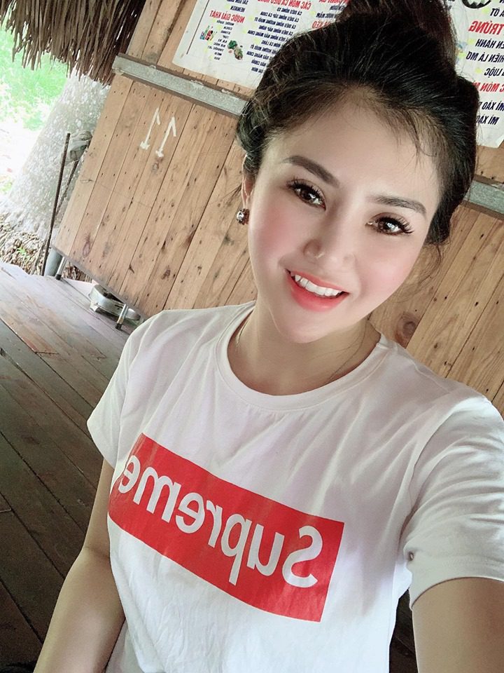 Bấm mí Hàn Quốc