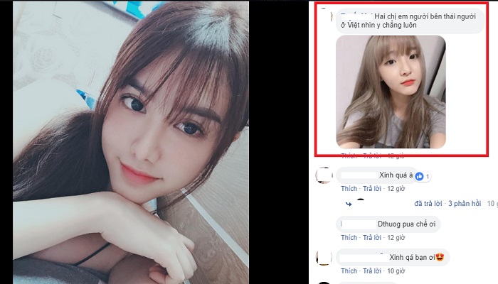 Cắt mí mắt